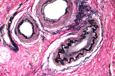 吉林弹力纤维染色