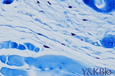 吉林甲苯胺蓝染色