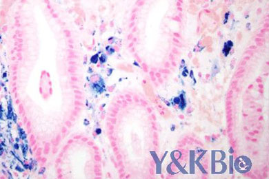 吉林普鲁士蓝染色