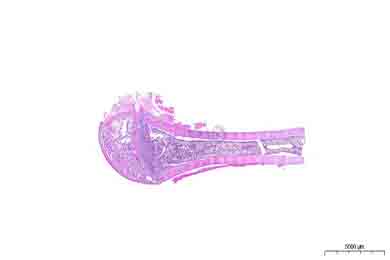 吉林脱钙（慢脱）