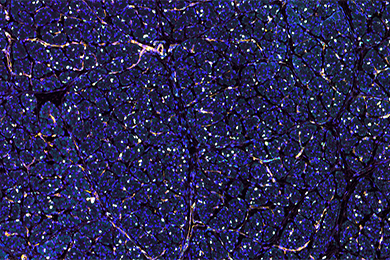 吉林普通切片免疫荧光四标（五色）染色