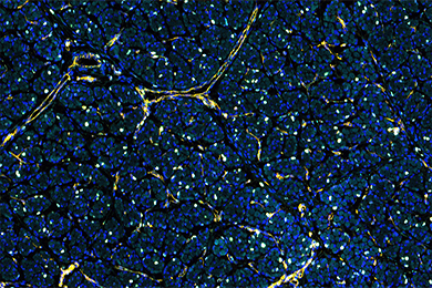 吉林普通切片免疫荧光五标（六色）染色