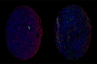 吉林组织芯片免疫荧光单标（双色）染色