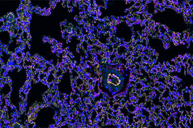 吉林组织芯片免疫荧光双标（三色）染色
