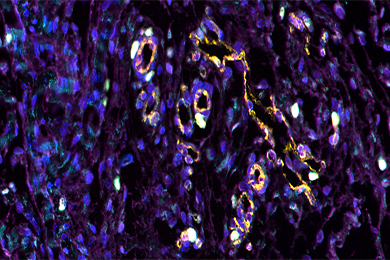 吉林普通切片（荧光五标