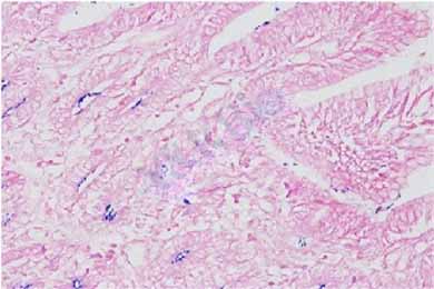 吉林革兰氏染色