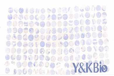 吉林白光芯片扫描