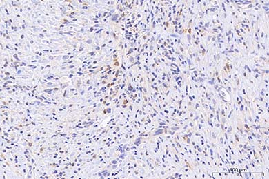 吉林Anti-iNOS Antibody