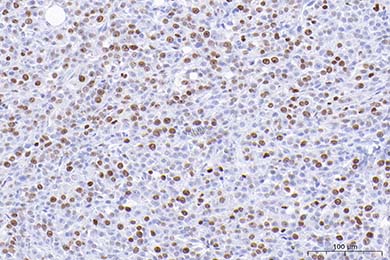 吉林Anti-Ki67 Antibody [SR00-02]