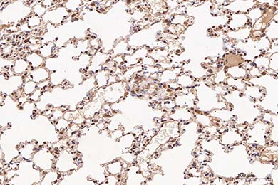 吉林NF-kB p65 Recombinant Rabbit Monoclonal Antibody [SZ10-04]