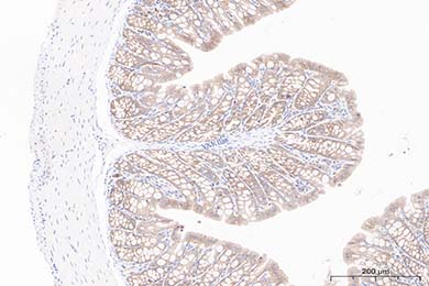 吉林Occludin Recombinant Rabbit Monoclonal Antibody [JJ091-08]